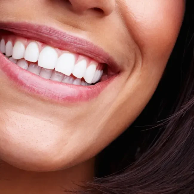 Full Mouth Reconstruction Bradenton, FL