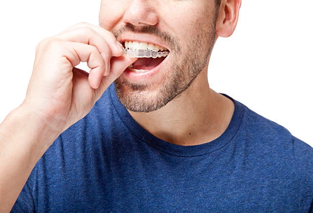 Man inserting clear dental aligner