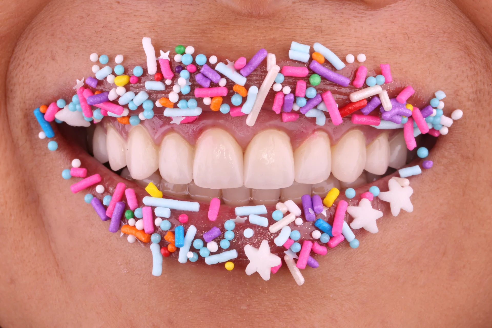 Teeth whitening