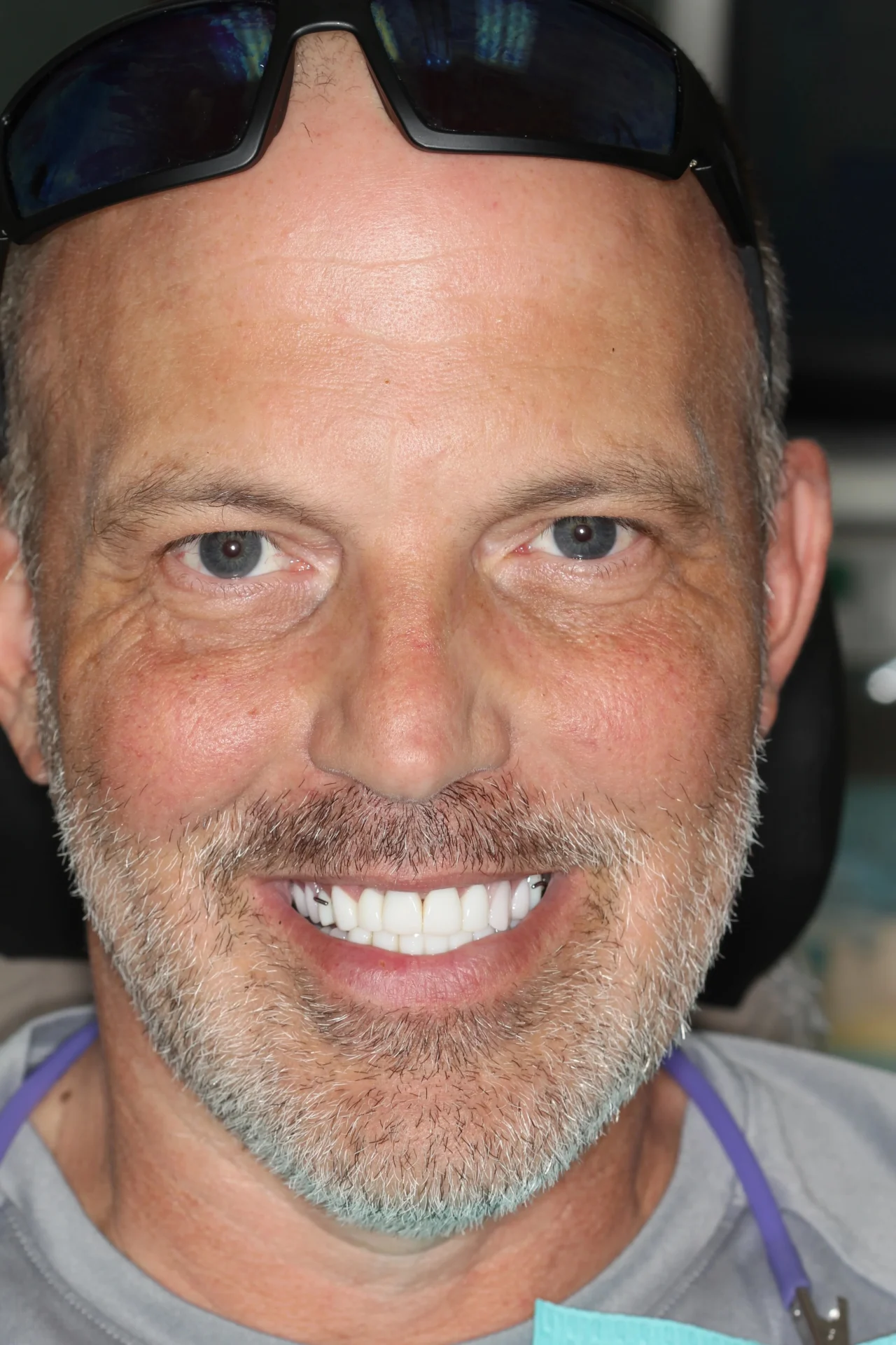 dental Implants