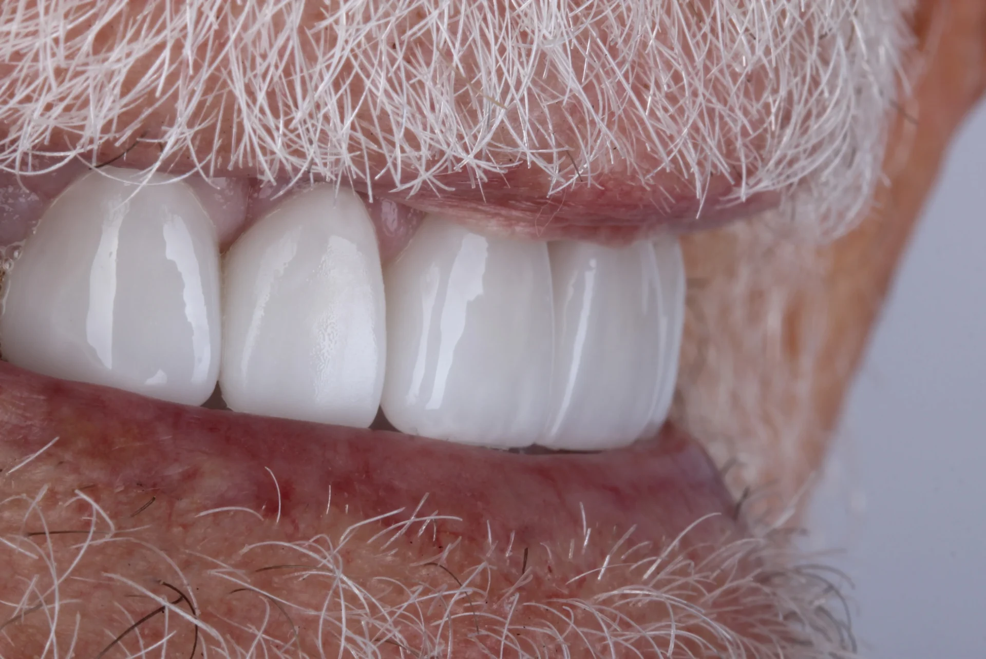 Close-up of white teeth and beard