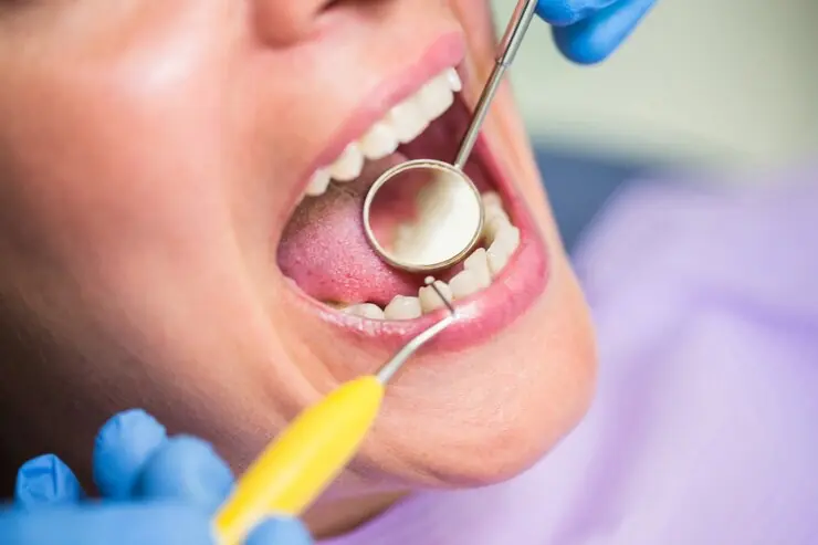 Dental examination with tools in mouth