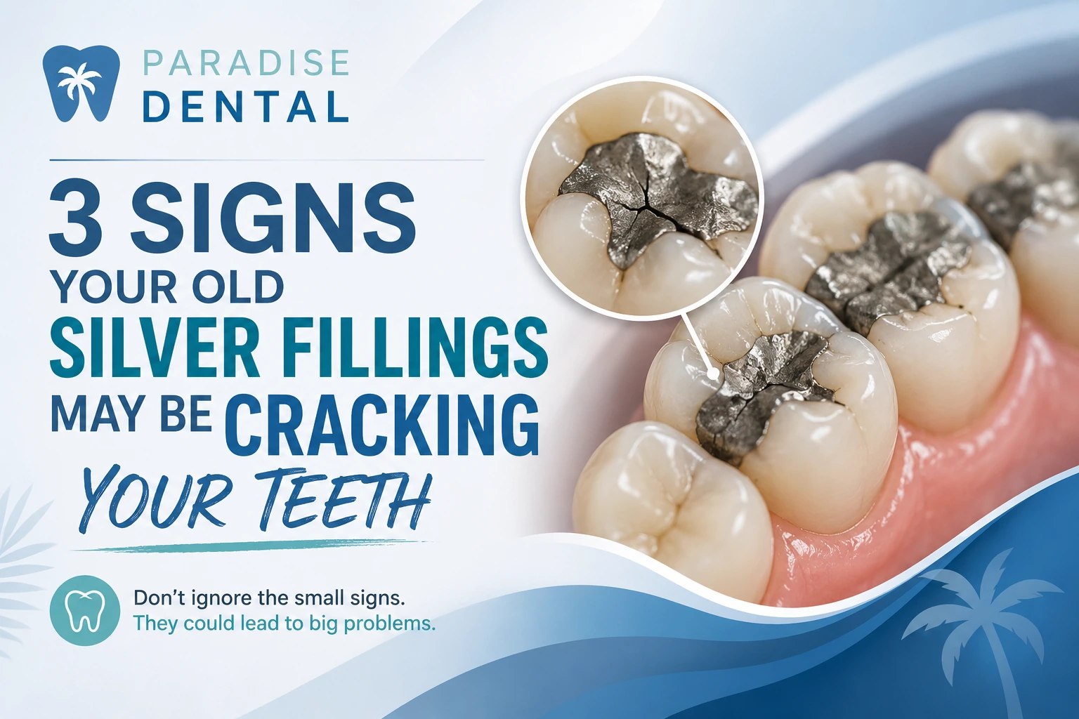 Old Silver Fillings