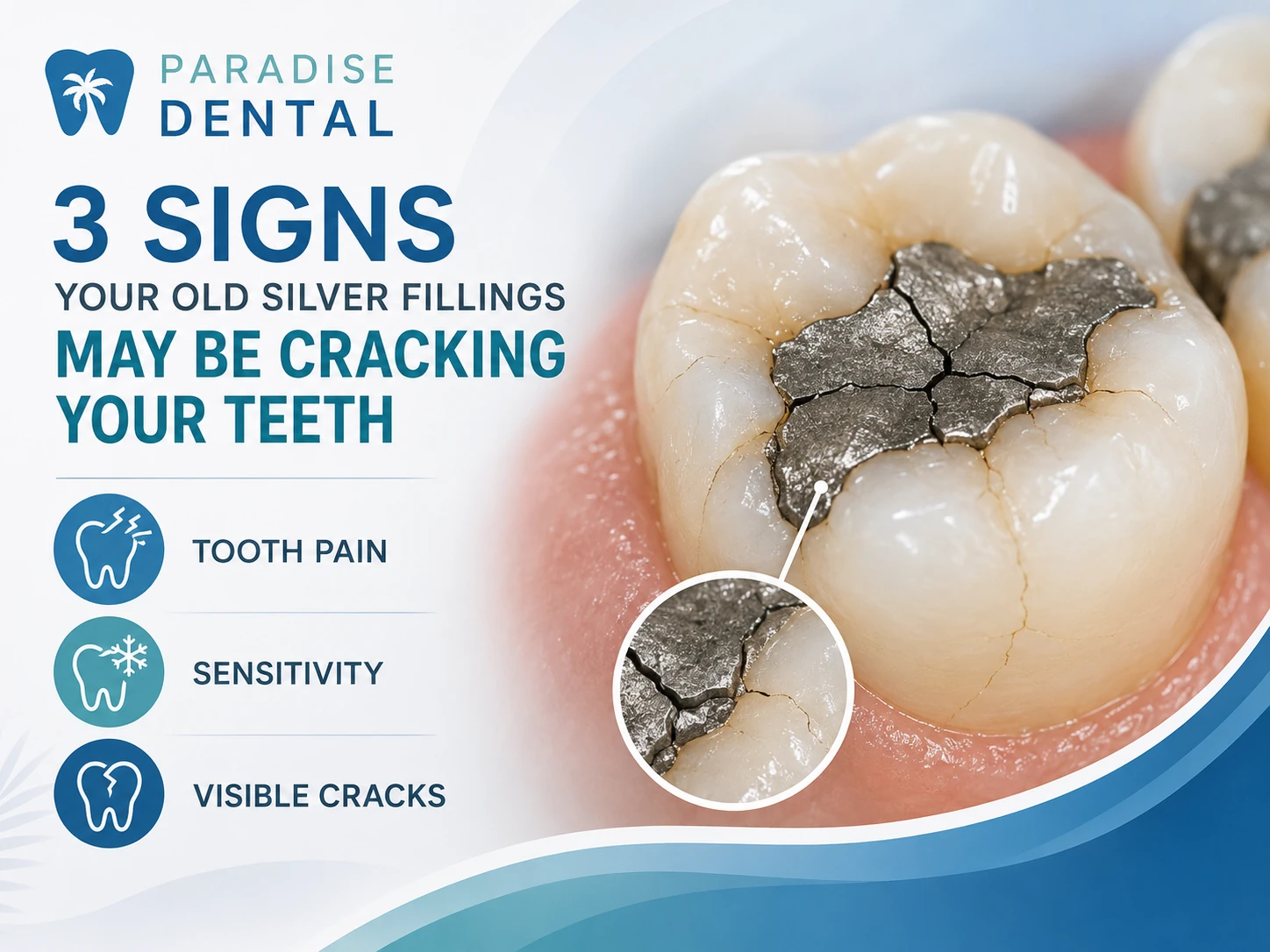 Cracking Your Teeth